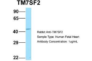 Host: Rabbit Target Name: TM7SF2 Sample Type: Human Fetal Heart Antibody Dilution: 1.