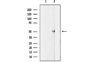 anti-Ribosomal RNA Processing 8 (RRP8) (Internal Region) antibody