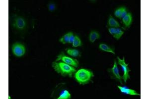 Immunofluorescent analysis of MCF-7 cells using ABIN7172949 at dilution of 1:100 and Alexa Fluor 488-congugated AffiniPure Goat Anti-Rabbit IgG(H+L) (TMCO5A anticorps  (AA 10-192))