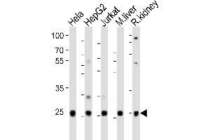 Western blot analysis of lysates from Hela, HepG2, Jurkat cell line, mouse liver, rat kidney tissue(from left to right), using UBB(Ubiquitin) Antibody (N-term) (ABIN6242685 and ABIN6577623). (Ubiquitin B anticorps  (N-Term))