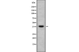 Western blot analysis of CA10 using HuvEc whole cell lysates (CA10 anticorps  (C-Term))