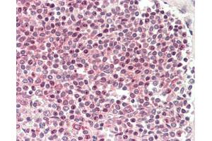 Human Spleen: Formalin-Fixed, Paraffin-Embedded (FFPE)