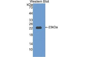Western blot analysis of the recombinant protein. (IL12RB1 anticorps  (AA 37-234))