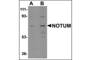 Western blot analysis of NOTUM AP30609PU-N antibody in Human kidney tissue lysate at 0. (NOTUM anticorps  (N-Term))