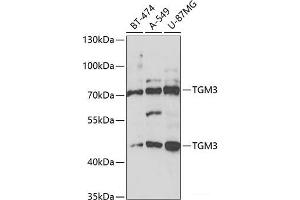 Western blot analysis of extracts of various cell lines using TGM3 Polyclonal Antibody at dilution of 1:1000. (TGM3 anticorps)