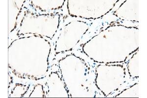 Immunohistochemical staining of paraffin-embedded Human lung tissue using anti-TACC3 mouse monoclonal antibody. (TACC3 anticorps)