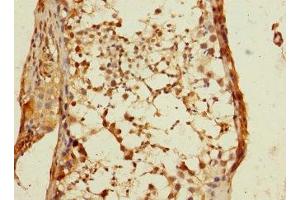 Immunohistochemistry of paraffin-embedded human testis tissue using ABIN7150696 at dilution of 1:100 (DSTYK anticorps  (AA 680-929))