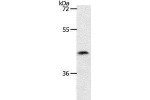 Western Blot analysis of 231 cell using PLAT Polyclonal Antibody at dilution of 1:450 (PLAT anticorps)