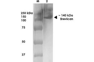 Western Blot analysis of Rat Brain Membrane showing detection of ~140 kDa Brevican protein using Mouse Anti-Brevican Monoclonal Antibody, Clone S294A-6 . (BCAN anticorps  (AA 219-655) (Biotin))