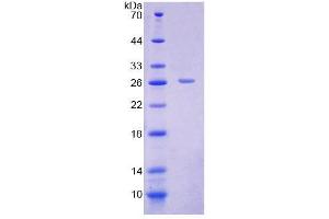 SDS-PAGE (SDS) image for Solute Carrier Family 25 (Carnitine/acylcarnitine Translocase), Member 20 (SLC25A20) (AA 1-211) protein (His tag) (ABIN4988801) (SLC25A20 Protein (AA 1-211) (His tag))