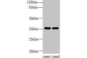 Western blot All lanes: NAIF1 antibody at 6 μg/mL Lane 1: Mouse brain tissue Lane 2: Mouse heart tissue Secondary Goat polyclonal to rabbit IgG at 1/10000 dilution Predicted band size: 36, 18 kDa Observed band size: 36 kDa (NAIF1 anticorps  (AA 1-172))