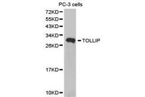Western Blotting (WB) image for anti-Toll Interacting Protein (TOLLIP) antibody (ABIN1875154) (TOLLIP anticorps)