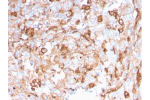 Formalin-fixed, paraffin-embedded human Kidney stained with PAI-RBP1 Mouse Monoclonal Antibody (SERBP1/3496).