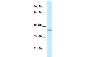 Western Blot showing NUDT6 antibody used at a concentration of 1 ug/ml against Fetal Brain Lysate (NUDT6 anticorps  (Middle Region))