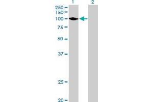 Western Blot analysis of HK2 expression in transfected 293T cell line by HK2 MaxPab polyclonal antibody. (Hexokinase 2 anticorps  (AA 1-917))