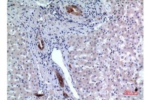 Immunohistochemistry (IHC) analysis of paraffin-embedded Human Liver, antibody was diluted at 1:100. (CD37 anticorps  (Internal Region))