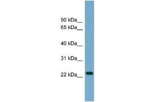 Human THP-1; WB Suggested Anti-ARL8B Antibody Titration: 0. (ARL8B anticorps  (Middle Region))