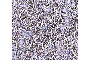IHC analysis of BCKDHA using anti-BCKDHA antibody (ABIN7601223).