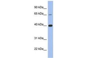 Image no. 1 for anti-Estrogen Receptor 1 (ESR1) (C-Term) antibody (ABIN6746024) (Estrogen Receptor alpha anticorps  (C-Term))