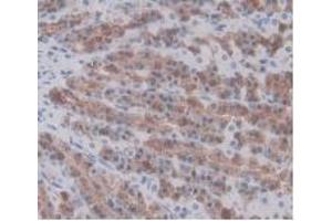 IHC-P analysis of Rat Stomach Tissue, with DAB staining. (Prothrombin anticorps  (AA 201-323))