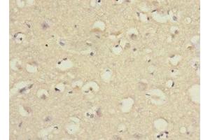 Immunohistochemistry of paraffin-embedded human brain tissue using ABIN7166554 at dilution of 1:100 (Protocadherin 1 anticorps  (AA 515-715))