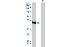 Western Blot analysis of CRX expression in transfected 293T cell line by CRX monoclonal antibody (M02), clone 4G11. (CRX anticorps  (AA 1-95))