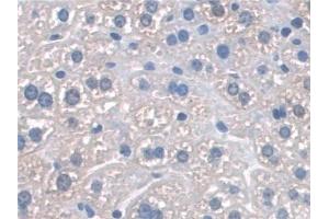 Detection of SNAP23 in Mouse Liver Tissue using Polyclonal Antibody to Synaptosomal Associated Protein 23 kDa (SNAP23) (SNAP23 anticorps  (AA 1-210))