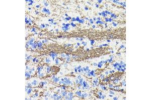 Immunohistochemistry of paraffin-embedded rat brain using CNPase Rabbit mAb (ABIN7265322) at dilution of 1:100 (40x lens). (Cnpase anticorps)