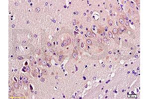 Formalin-fixed and paraffin embedded: rat brain tissue labeled with Anti-GAP-43 Polyclonal Antibody, Unconjugated (ABIN725555) at 1:300 followed by conjugation to the secondary antibody and DAB staining (GAP43 anticorps  (AA 9-100))
