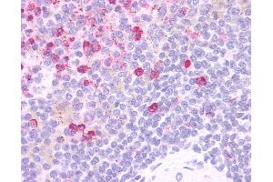 Anti-HCAR3 / GPR109B / HM74 antibody IHC of human spleen. (GPR109B anticorps  (Cytoplasmic Domain))