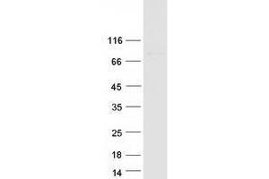 Validation with Western Blot