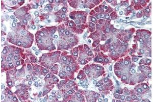 Pancreas, Human: Formalin-Fixed, Paraffin-Embedded (FFPE)