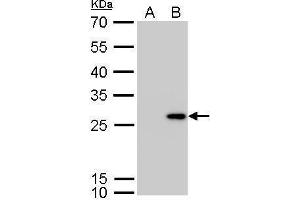 WB Image Calretinin antibody detects CALB2 protein by Western blot analysis. (Calretinin anticorps)