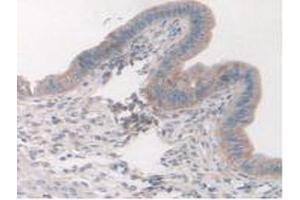 Figure. (Cortactin anticorps  (AA 1-509))