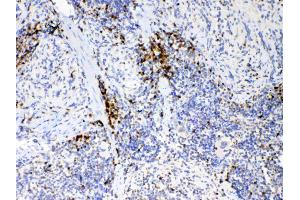 IHC analysis of IL17 using anti-IL17 antibody .
