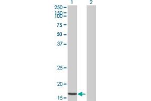 Western Blot analysis of STK10 expression in transfected 293T cell line by STK10 MaxPab polyclonal antibody. (STK10-A anticorps  (AA 12-144))