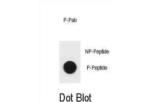 Dot blot analysis of mouse BAD Antibody (Phospho S96) Phospho-specific Pab (ABIN1881096 and ABIN2839955) on nitrocellulose membrane. (BAD anticorps  (pSer96))
