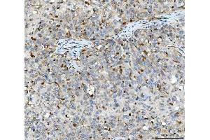 IHC analysis of Aurora A/AURKA using anti-Aurora A/AURKA antibody (ABIN7600751). (Aurora A anticorps  (AA 23-403))