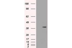 Image no. 3 for anti-3-hydroxyisobutyryl-CoA Hydrolase (HIBCH) antibody (ABIN1498658)