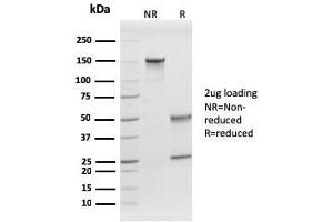 SDS-PAGE Analysis Purified Prohibitin Mouse Monoclonal Antibody (PHB/1882). (Prohibitin anticorps  (AA 167-261))
