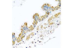 Immunohistochemistry of paraffin-embedded human trachea using PCDHA12 antibody at dilution of 1:100 (x40 lens). (PCDHA12 anticorps)