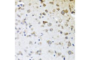 Immunohistochemistry of paraffin-embedded mouse brain using CP antibody (ABIN6129673, ABIN6138930, ABIN6138932 and ABIN6217722) at dilution of 1:100 (40x lens).