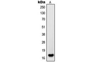 Western blot analysis of PDGFA expression in HL60 (A) whole cell lysates.