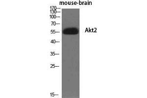 Western Blot (WB) analysis of specific cells using Akt2 Polyclonal Antibody.