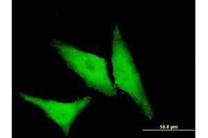 Immunofluorescence of monoclonal antibody to HSPB1 on HeLa cell.