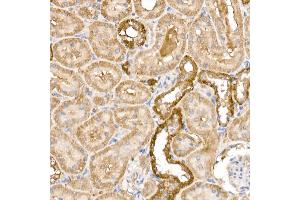 Immunohistochemistry of paraffin-embedded rat kidney using GPLD1 Rabbit pAb (ABIN6131716, ABIN6141335, ABIN6141336 and ABIN6222300) at dilution of 1:100 (40x lens). (GPLD1 anticorps  (AA 24-160))