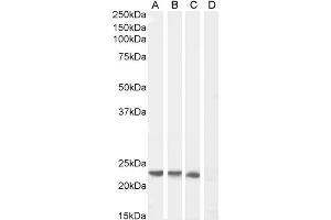 ABIN184575 (0. (SOCS1 anticorps  (C-Term))