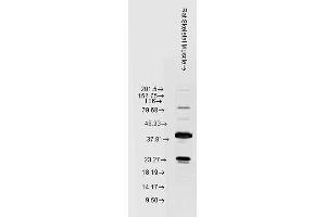 Western blot analysis of Rat Skeletal muscle lysates showing detection of HSP22 protein using Rabbit Anti-HSP22 Polyclonal Antibody (ABIN361851 and ABIN361852). (HSPB8 anticorps)
