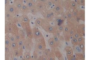 DAB staining on IHC-P; Samples: Human Liver Tissue (PTX3 anticorps  (AA 183-381))
