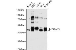 Western blot analysis of extracts of various cell lines, using TRDMT1 antibody (ABIN6131596, ABIN6149479, ABIN6149480 and ABIN6214817) at 1:1000 dilution.